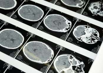 Neuroplasticity: How to help children develop a powerful brain